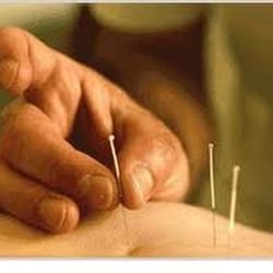 California Acupuncture and Natural Medicine