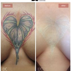 Derma Laser Centers