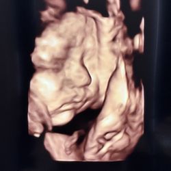 Baby’s First Glance