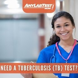 Any Lab Test Now - Ahwatukee - Quantiferon Gold Plus TB Test.