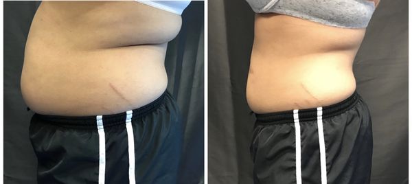 Body Sculpting - Body Sculpting Body Sculpting - Body Sculpting