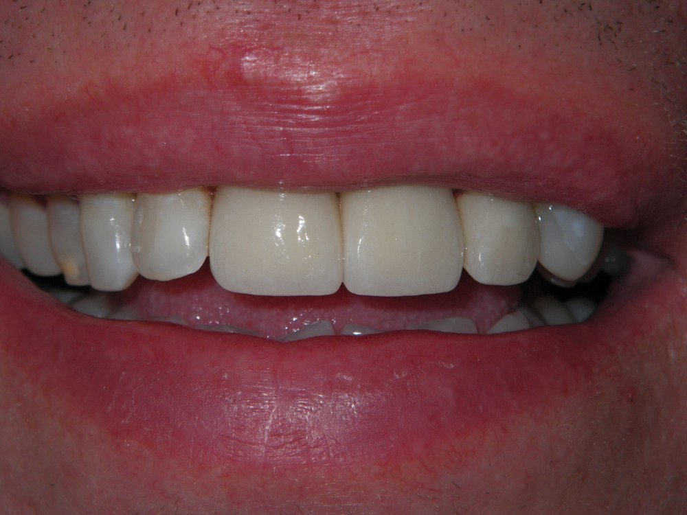 ARLINGTON COMFORT DENTAL Updated September 2024 15 Photos & 15