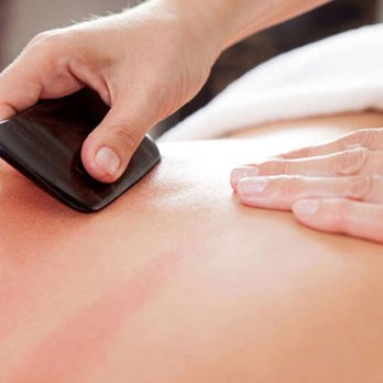 Acupuncture Plus - Acupuncture Near Me