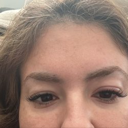 Sherry Lash Studio - Swelling itching burning