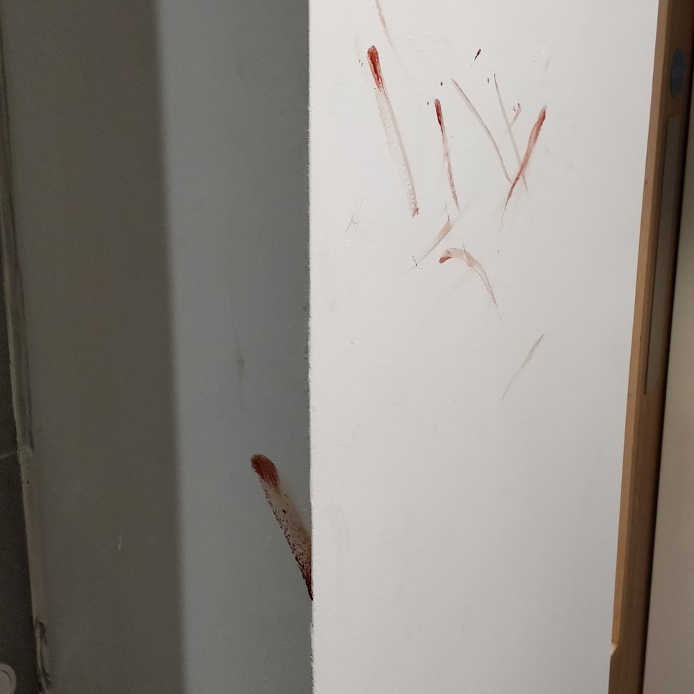 Arran House - What kind of hygiene standards does this shithole have - University Housing Near Me - Edinburgh, EDH