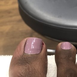Cut toenail