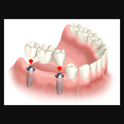 Tiger Smile Family Dentistry