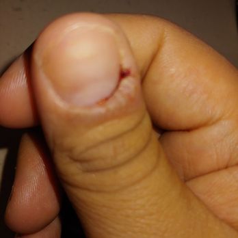 Vans Nail's - After 2 weeks i took my nails off - Nail Salons Near Me - Lemon Grove, California Vans Nail's - After 2 weeks i took my nails off - Nail Salons Near Me - Lemon Grove, California