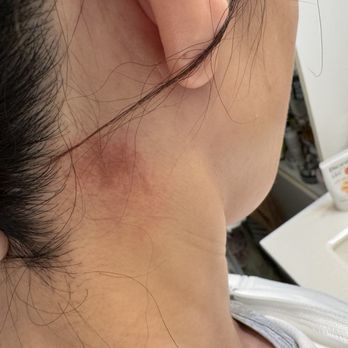 Kume Spa - ay 19 street branch. Windy gave me massage it was too strong and she has too long nails . - Massage Near Me - Oakland, California Kume Spa - ay 19 street branch. Windy gave me massage it was too strong and she has too long nails . - Massage Near Me - Oakland, California