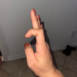 Lumpy nails, uncleaned cuticles