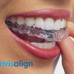 Hearthstone Dentistry - Invisalign treatment is the clear alternative to metal braces for kids, teens, and adults.