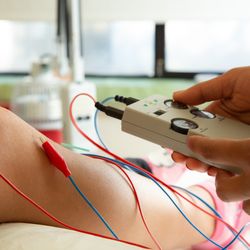 Rebel Med NW - Acupuncture with E-Stim