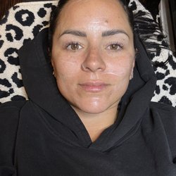 Lash lift tint, dermaplane treatment, before brow lamination