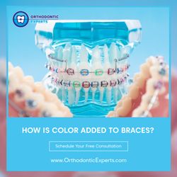 Orthodontic Experts - Arlington Heights - Nowadays your child can enjoy the colorful customization with their braces on. Visit our website to read more about these color rubber bands