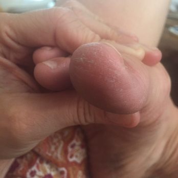 Avenue Nail Spa - Eeeeew! This is after my pedi?! This is not normal... - Nail Salons Near Me - Oak Park, Illinois