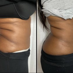 Divine Curves - Results after 1-2 treatments