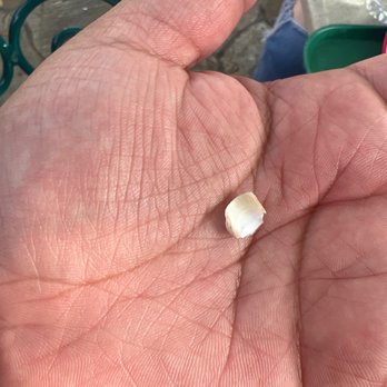 Happiness Nails & Spa - Update: my toenail came off. - Nail Salons Near Me - Tulare, California Happiness Nails & Spa - Update: my toenail came off. - Nail Salons Near Me - Tulare, California