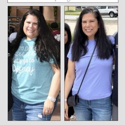 Harmony Aesthetics Spa - Before and After-- 104 pounds lost in a year with semaglutide.