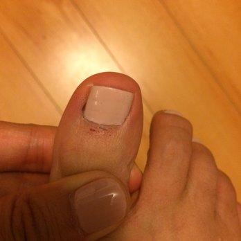 Nailbox Studio - My friend's toe that got so cut up! I mean how do you get cut on the bottom? That's not even a cuticle! It started to bleed too... - Nail Salons Near Me - Los Angeles, California Nailbox Studio - My friend's toe that got so cut up! I mean how do you get cut on the bottom? That's not even a cuticle! It started to bleed too... - Nail Salons Near Me - Los Angeles, California