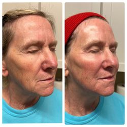 BeneVita Aesthetics And Wellness