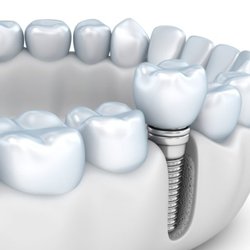 Toupin Dental & Associates