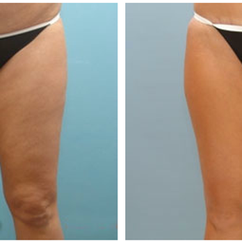 Laser MD MedSpa - Medical Spas Near Me - Natick, Massachusetts