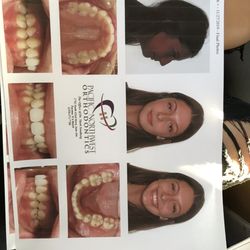 Pacific Northwest Orthodontics - After!!!!