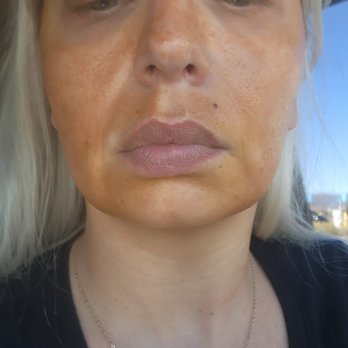 Skin Solutions Aesthestics - Medical Spas Near Me - Calimesa, California Skin Solutions Aesthestics - Medical Spas Near Me - Calimesa, California