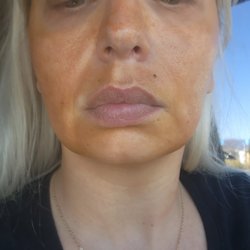 Skin Solutions Aesthestics