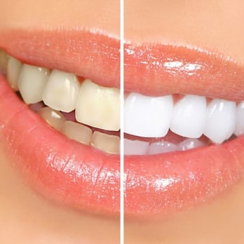 Allure Smile Center - General Dentistry Near Me - Miami Lakes, Florida Allure Smile Center - General Dentistry Near Me - Miami Lakes, Florida