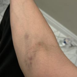 Quest Diagnostics - Update 2 days later