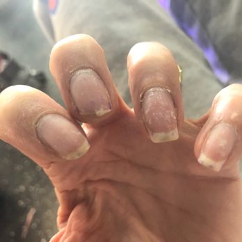 Top Nails Spa - Damaged nails - Nail Salons Near Me - Henderson, Nevada