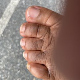 This is how my toes looked after the pedicure. This is how my toes looked after the pedicure.