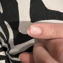 NT Nails & Spa - The nail she ripped off causing me to bleed.