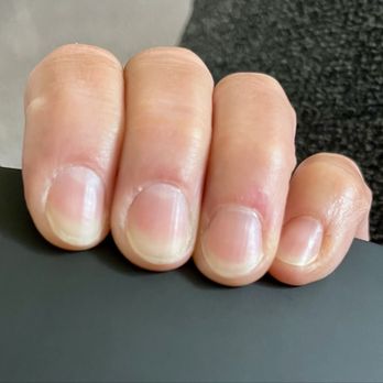 Fancy Nails & Spa - Cuticles/skin slightly irritated and tender - Nail Salons Near Me - Visalia, California Fancy Nails & Spa - Cuticles/skin slightly irritated and tender - Nail Salons Near Me - Visalia, California