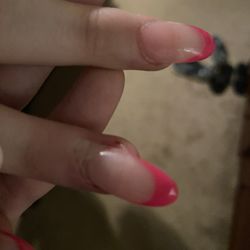 Style Nails - Where my skin is peeling