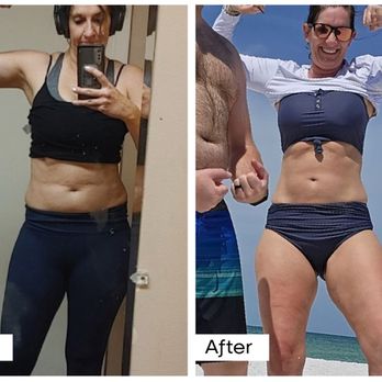 BelleSculpt - Body Contouring Near Me - Idaho Falls, Idaho