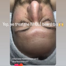 Men love our facials!