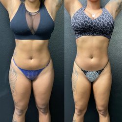 OC Body Clinic - Body scultping + Ems
