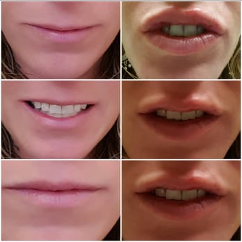 Gold Coast Plastic Surgery - George Moynihan, M.D - Skin Care Near Me - Chicago, Illinois