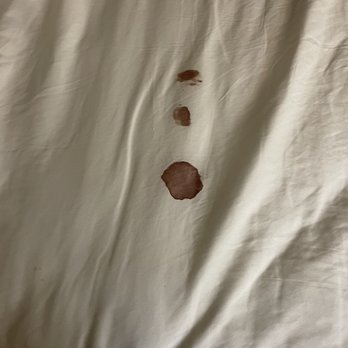Clarion Inn - Close up of blood stained bedding - Hotels Near Me - Pocatello, Idaho Clarion Inn - Close up of blood stained bedding - Hotels Near Me - Pocatello, Idaho