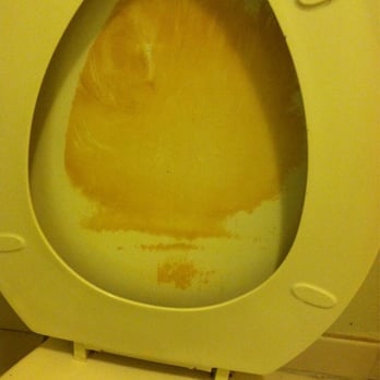 Country Hearth Inn - filthy TIOLET seat - Hotels Near Me - Cayce, South Carolina Country Hearth Inn - filthy TIOLET seat - Hotels Near Me - Cayce, South Carolina