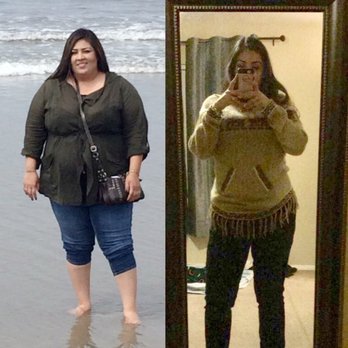 Las Vegas Bariatrics - Weight Loss Centers Near Me - Las Vegas, Nevada Las Vegas Bariatrics - Weight Loss Centers Near Me - Las Vegas, Nevada
