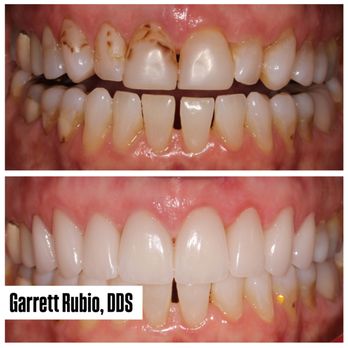 Garrett Rubio - General Dentistry Near Me - Dana Point, California