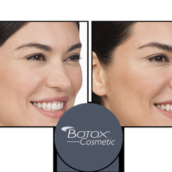 We offer Botox injections to help remove frown lines and wrinkles.