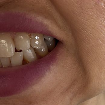 Kawaii Tooth Gems - Great experience! She is so sweet, very professional, super clean, and responds to messages quickly. I highly recommend her! - Jewelry Near Me Kawaii Tooth Gems - Great experience! She is so sweet, very professional, super clean, and responds to messages quickly. I highly recommend her! - Jewelry Near Me