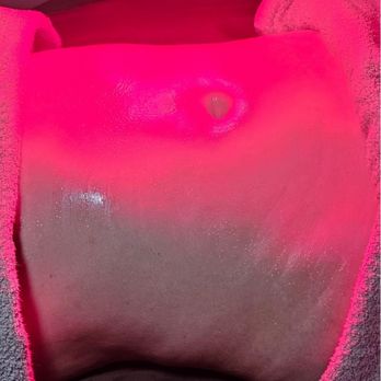 Spaofyouth - Before and after - Massage Therapy Near Me - Pasadena, California Spaofyouth - Before and after - Massage Therapy Near Me - Pasadena, California