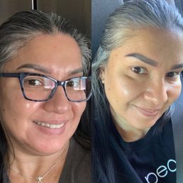 Glasses was a few months ago. No glasses was an hour after retouch. Glasses was a few months ago. No glasses was an hour after retouch.