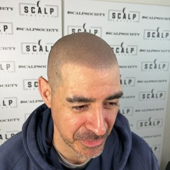 Scalp Society - Hair Loss Centers Near Me - San Jose, California