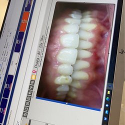 Family Orthodontics & Oral Surgery - After
